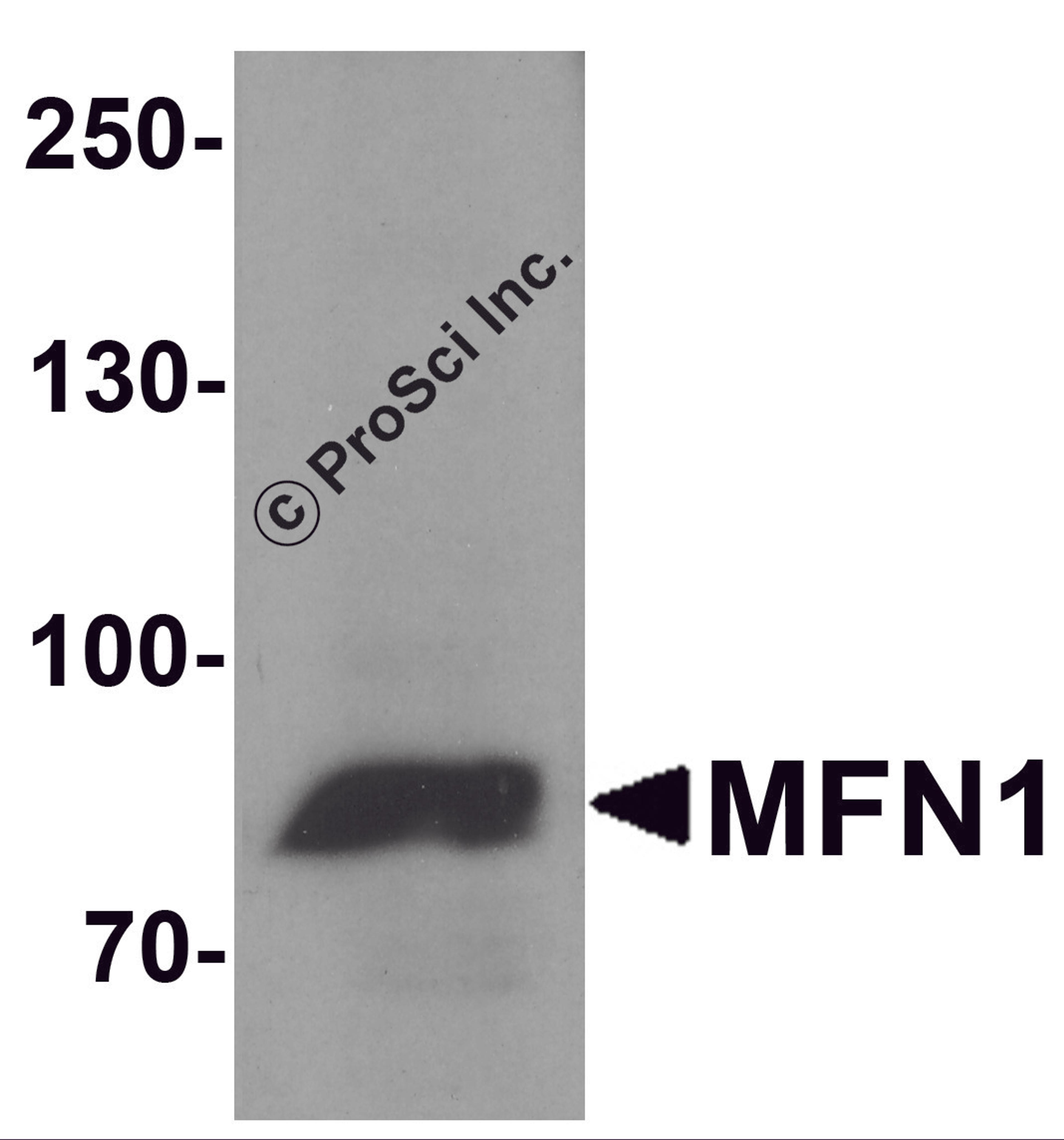 Western blot analysis of MFN1 in A431 cell lysate with MFN1 antibody at 1 μg/ml.