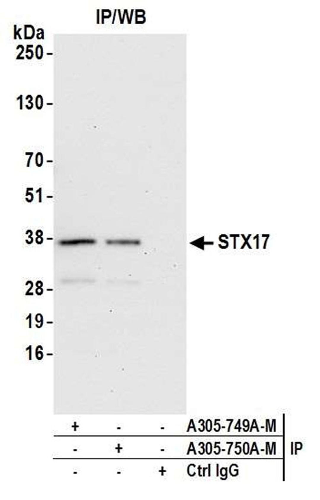 Detection of human STX17 by WB of IP.