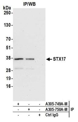 Detection of human STX17 by WB of IP.