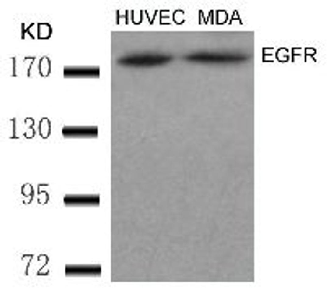 Western blot analysis of lysed extracts from HUVEC and MDA cells using EGFR (Ab-869).