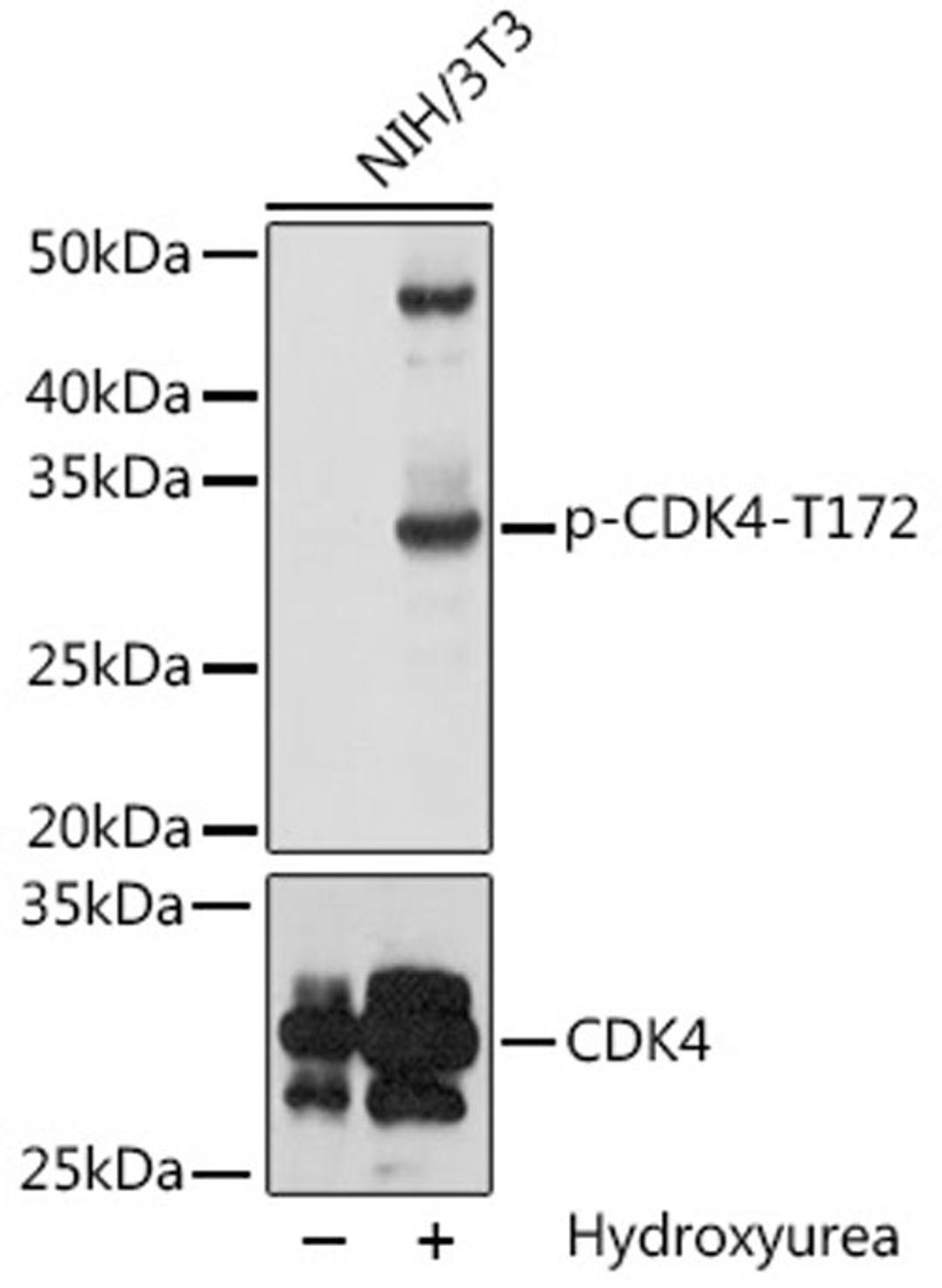 Western blot - Phospho-CDK4-T172 pAb (AP0593)