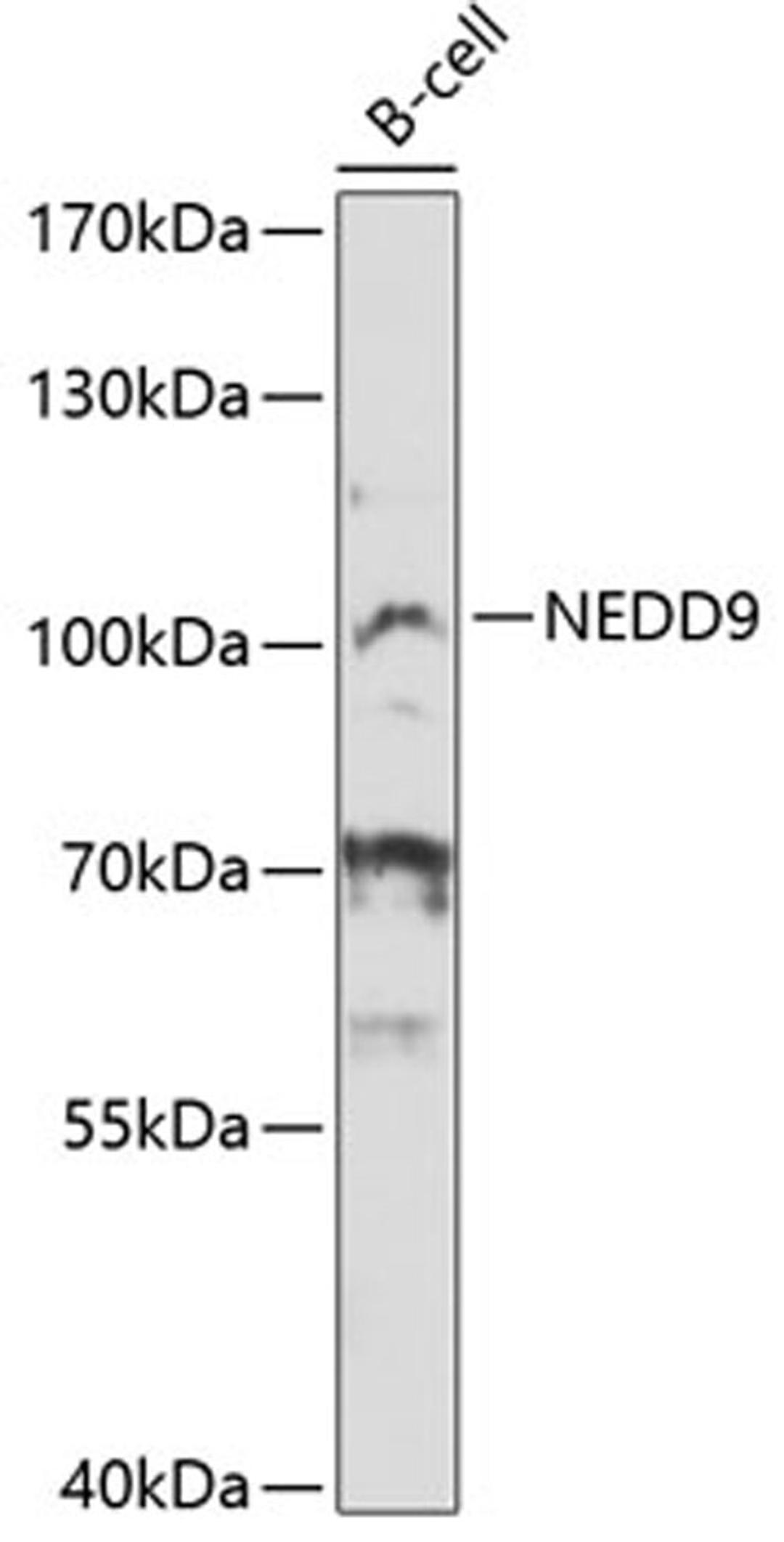 Western blot - NEDD9 Antibody (A12010)