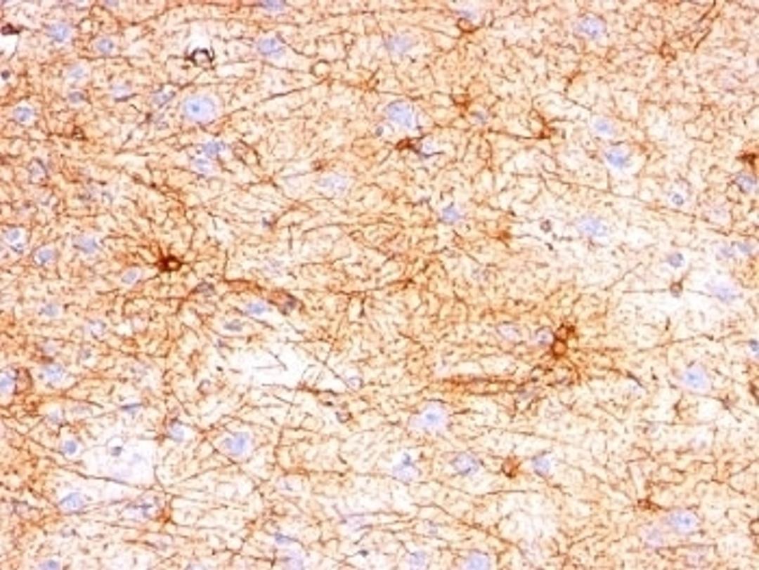 Formalin-fixed, paraffin-embedded human cerebellum stained with GFAP antibody (SPM507).