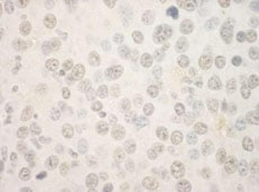 Detection of mouse FOXP1 by immunohistochemistry.