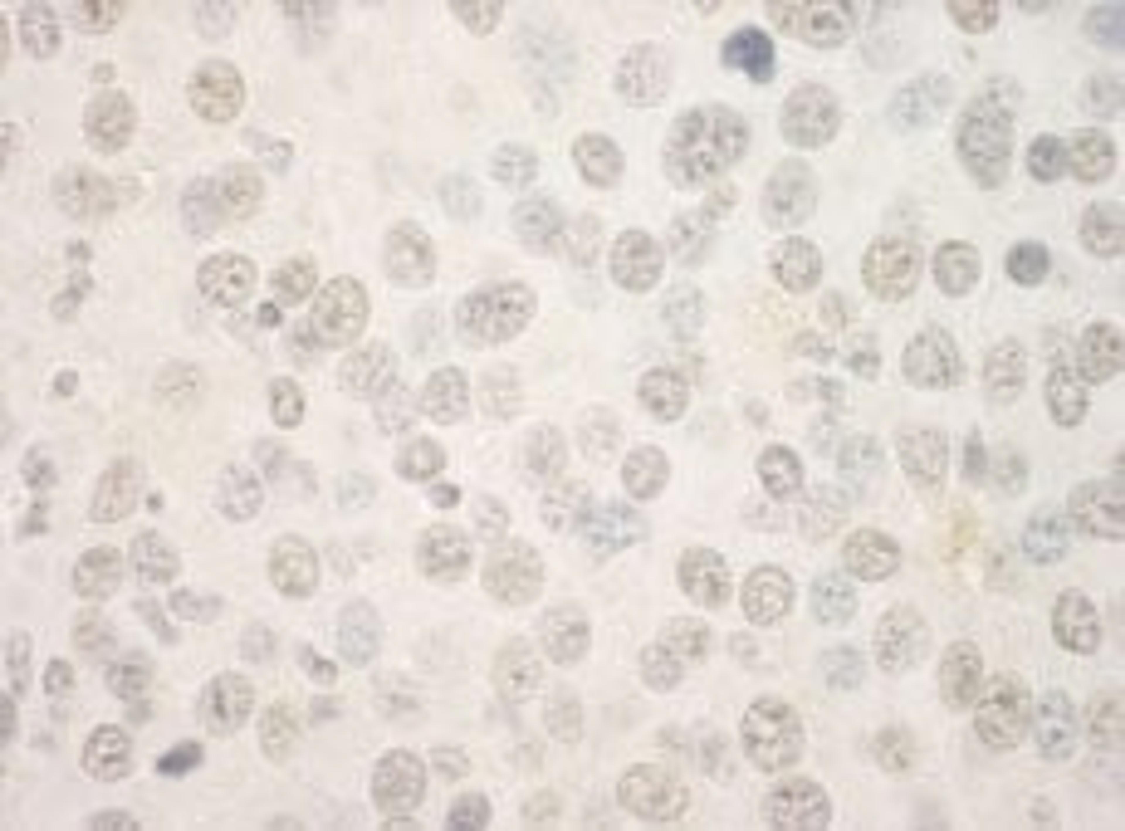 Detection of mouse FOXP1 by immunohistochemistry.