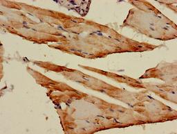 Immunohistochemistry of paraffin-embedded human skeletal muscle tissue using CSB-PA001508HA01HU at dilution of 1:100
