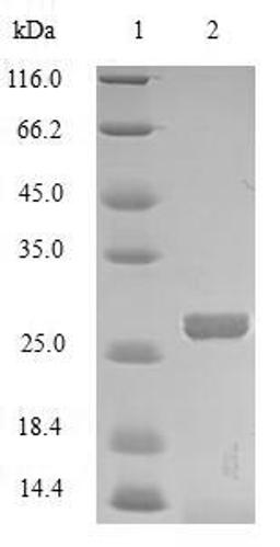 (Tris-Glycine gel) Discontinuous SDS-PAGE (reduced) with 5% enrichment gel and 15% separation gel.