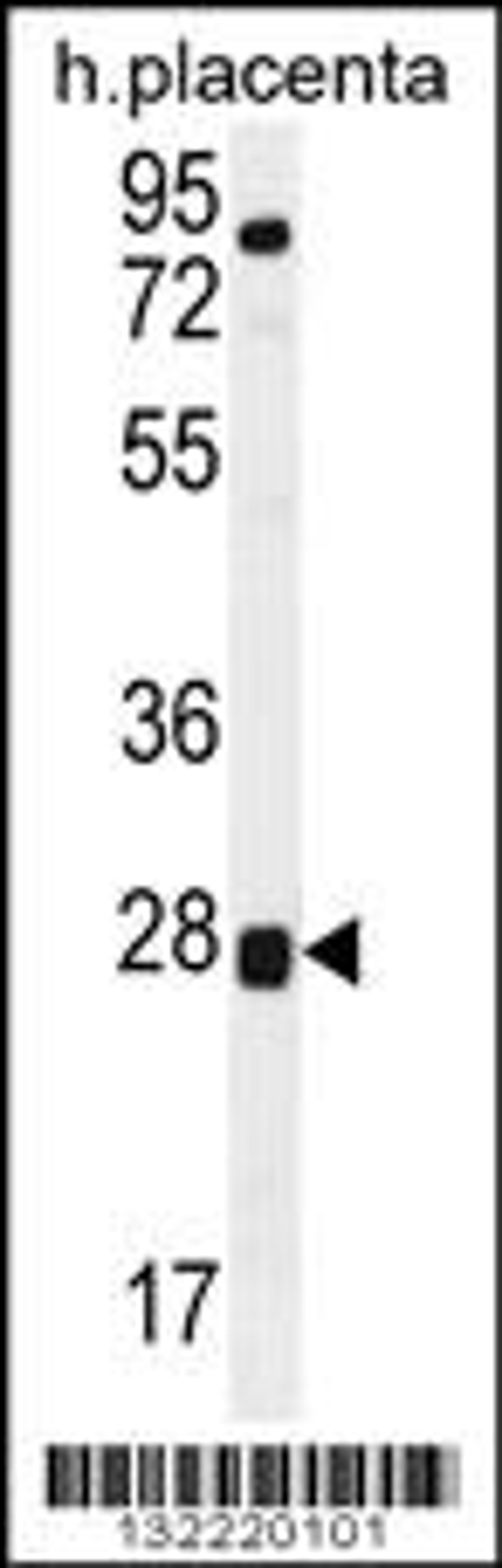 Western blot analysis in human placenta tissue lysates (35ug/lane).