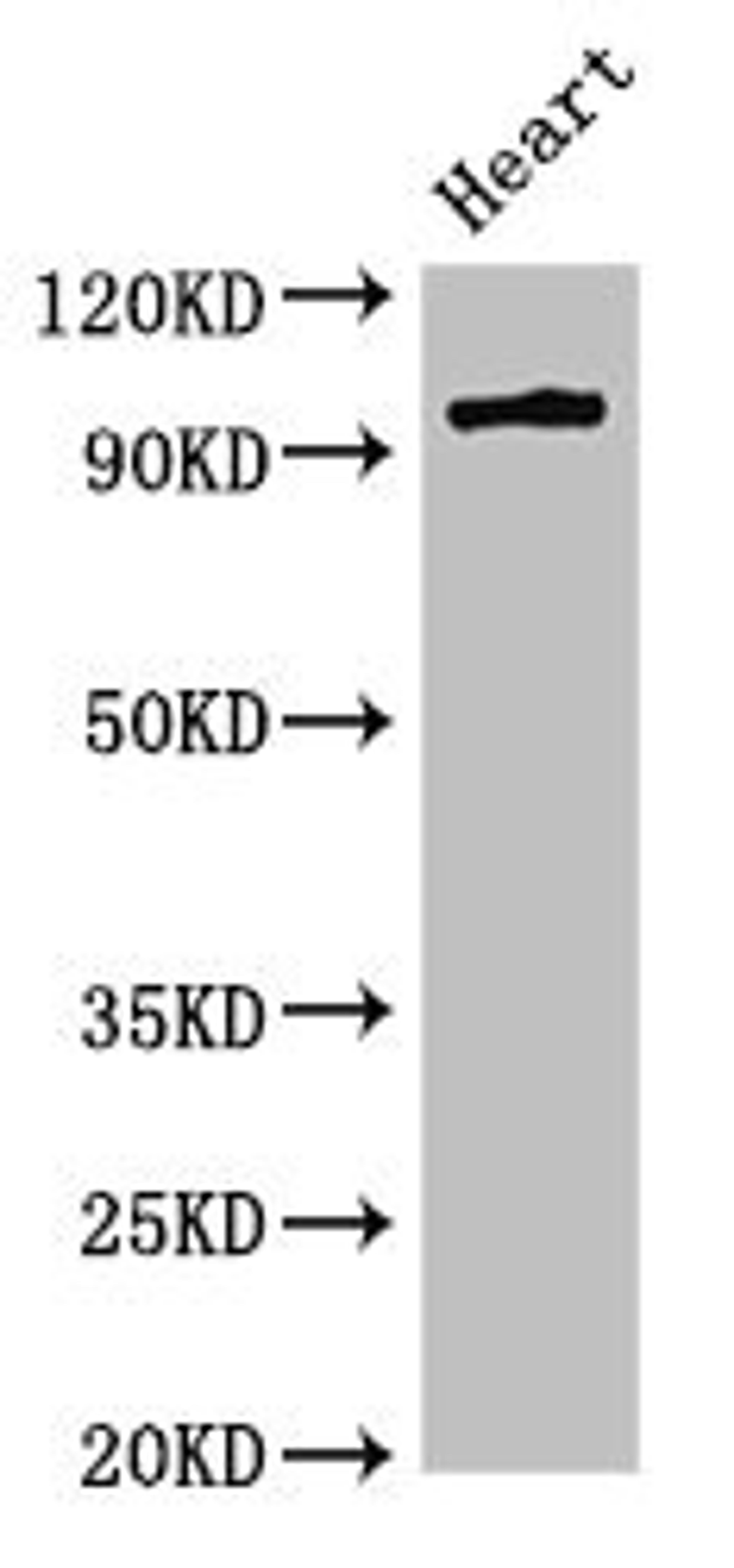 Western Blot. Positive WB detected in: Rat heart tissue. All lanes: PRKD3 antibody at 3ug/ml. Secondary. Goat polyclonal to rabbit IgG at 1/50000 dilution. Predicted band size: 101, 69 kDa. Observed band size: 101 kDa. 