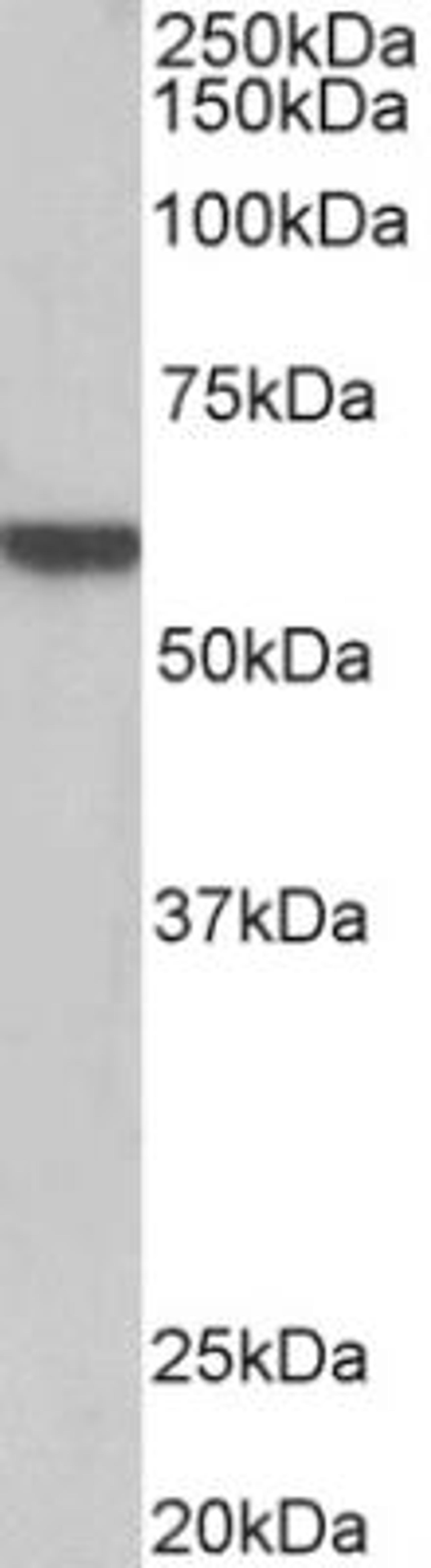 Western Blot: alpha-1B Adrenergic R/ADRA1B Antibody [NBP2-26181] - Pig Heart lysate (35 ug protein in RIPA buffer). Primary incubation was 1 hour. Detected by chemiluminescence.