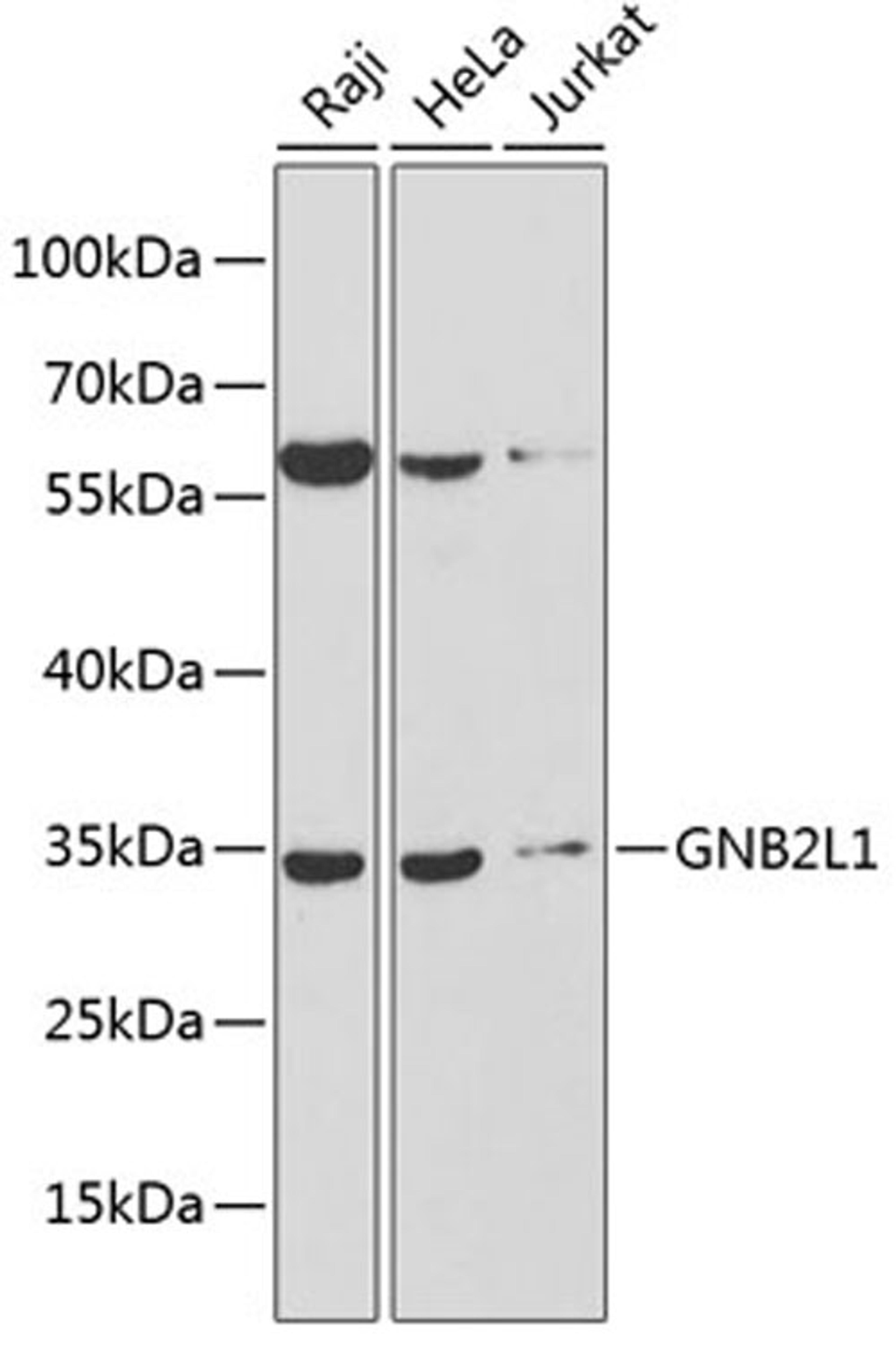 Western blot - GNB2L1 antibody (A13393)