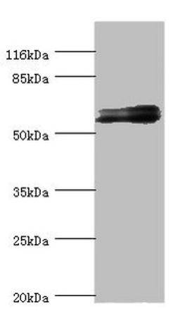 Western blot. All lanes: GABRR1 antibody at 1.25ug/ml + Mouse eye tissue. Secondary. Goat polyclonal to rabbit IgG at 1/10000 dilution. Predicted band size: 56, 54, 46 kDa. Observed band size: 56 kDa. 