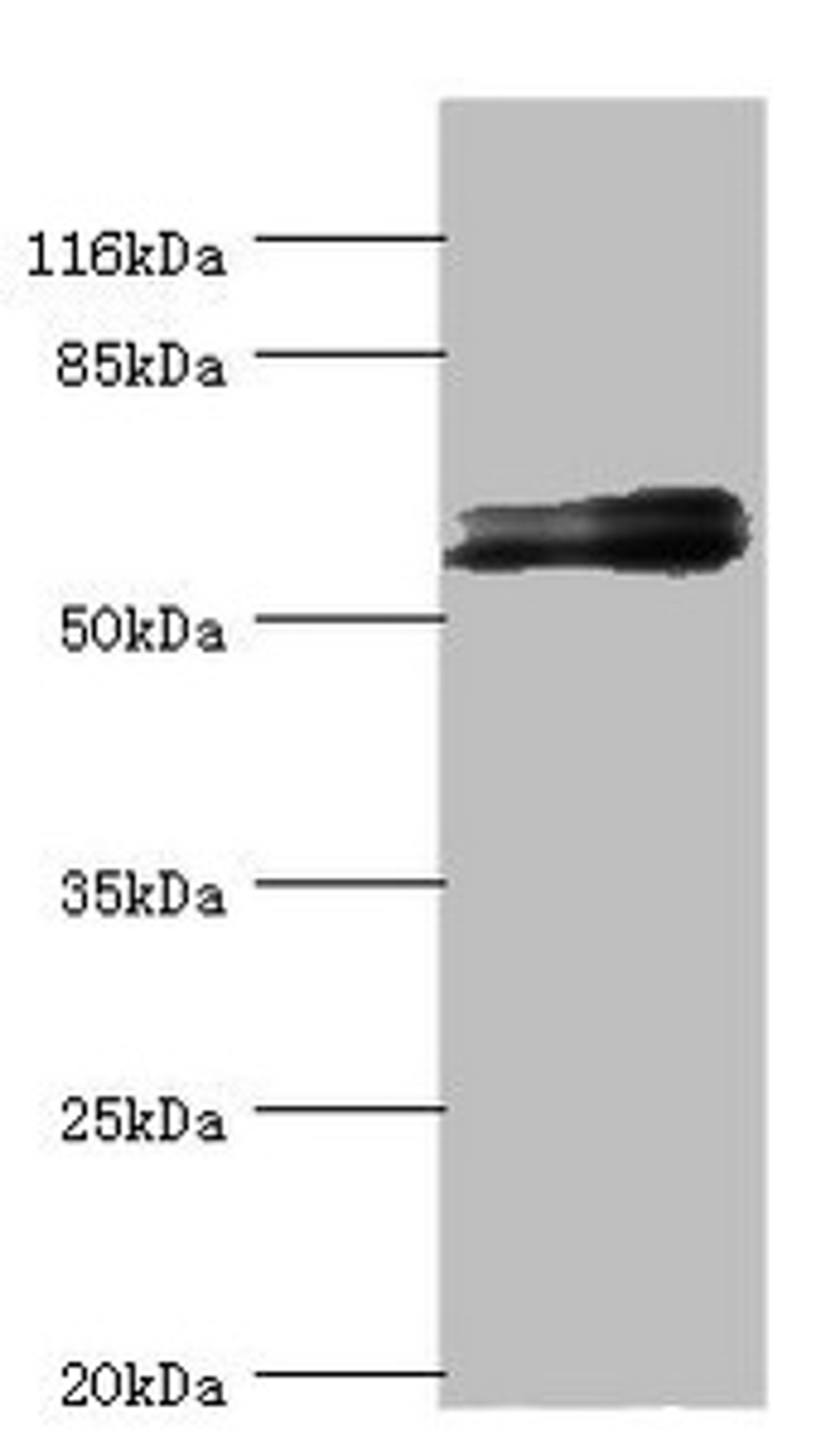 Western blot. All lanes: GABRR1 antibody at 1.25ug/ml + Mouse eye tissue. Secondary. Goat polyclonal to rabbit IgG at 1/10000 dilution. Predicted band size: 56, 54, 46 kDa. Observed band size: 56 kDa. 