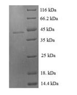 (Tris-Glycine gel) Discontinuous SDS-PAGE (reduced) with 5% enrichment gel and 15% separation gel.