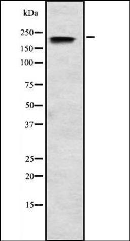 Western blot analysis of HEK293 cells using SCN3A antibody