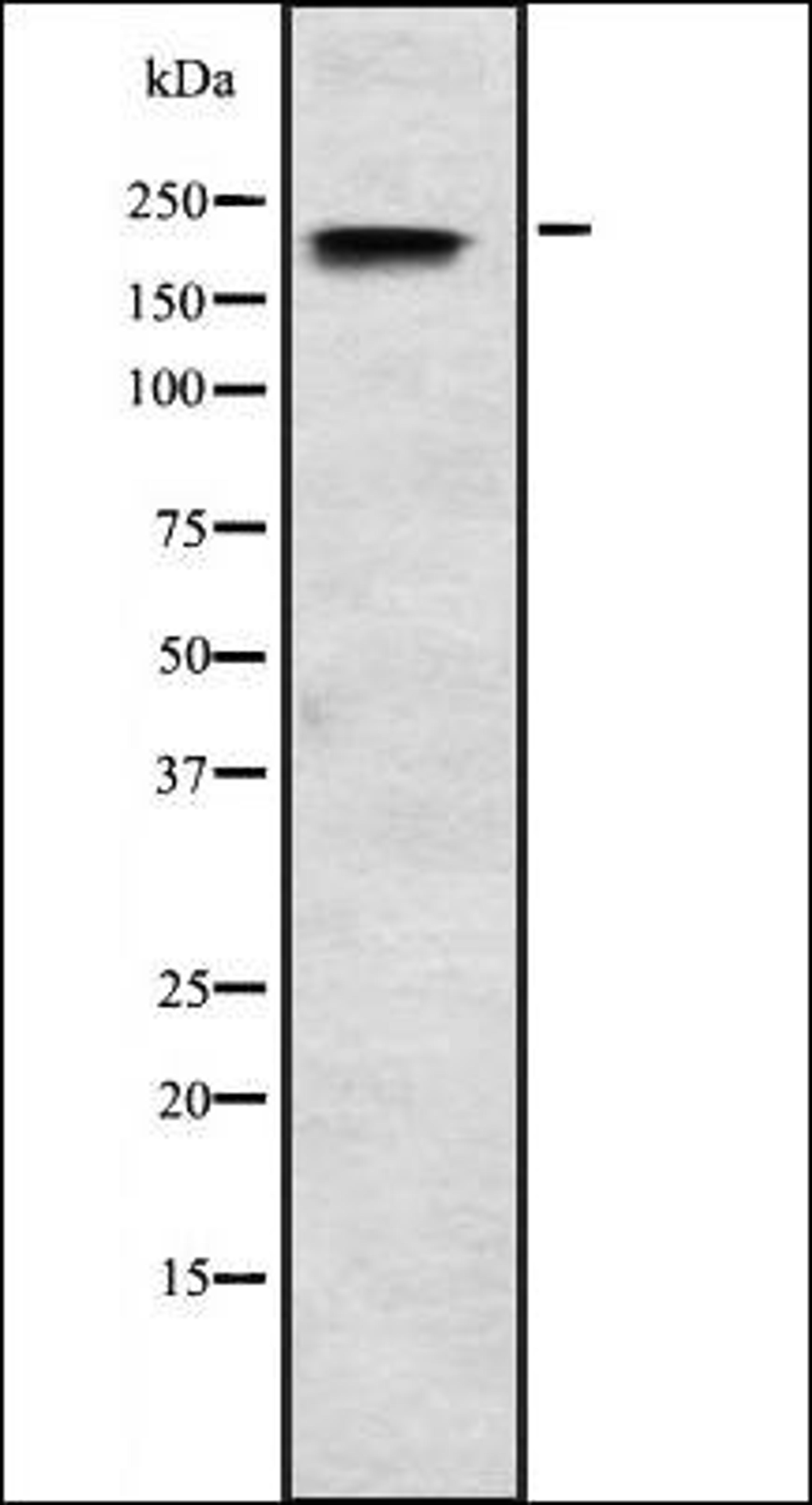 Western blot analysis of HEK293 cells using SCN3A antibody