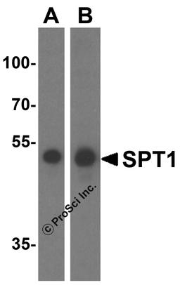 Western blot analysis of SPT1 in (A) A549 and (B) HeLa cell lysate with SPT1 antibody at 1 μg/mL.
