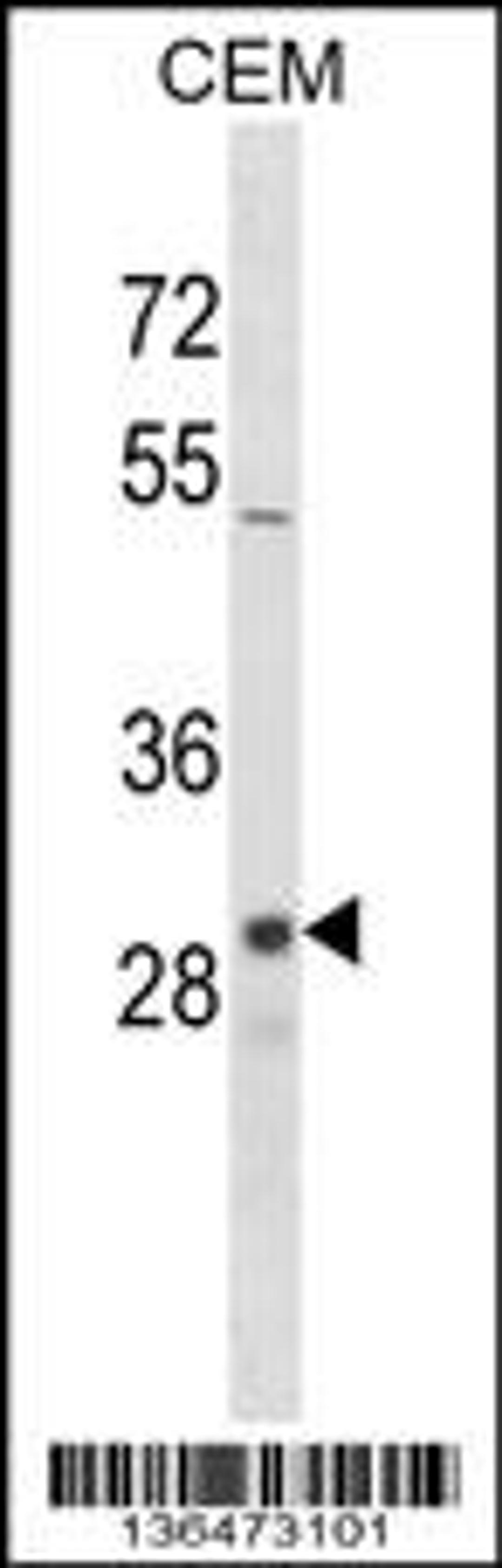 Western blot analysis in CEM cell line lysates (35ug/lane).