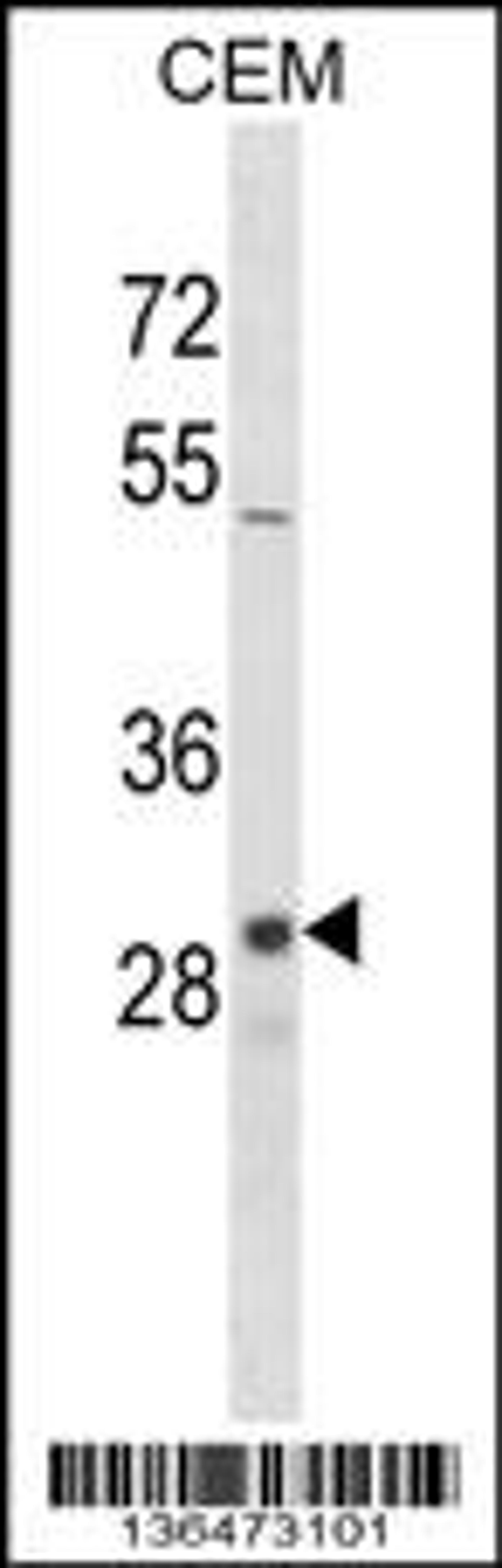 Western blot analysis in CEM cell line lysates (35ug/lane).