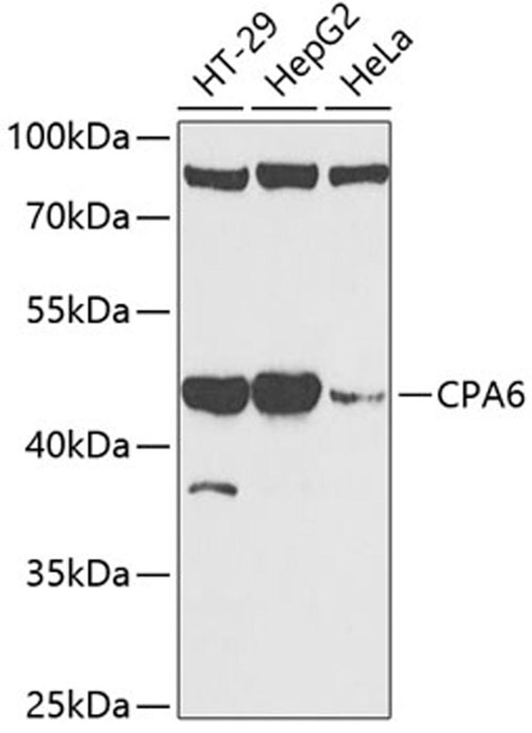 Western blot - CPA6 antibody (A13644)