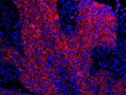 Detection of human 14-3-3 Sigma by immunohistochemistry.