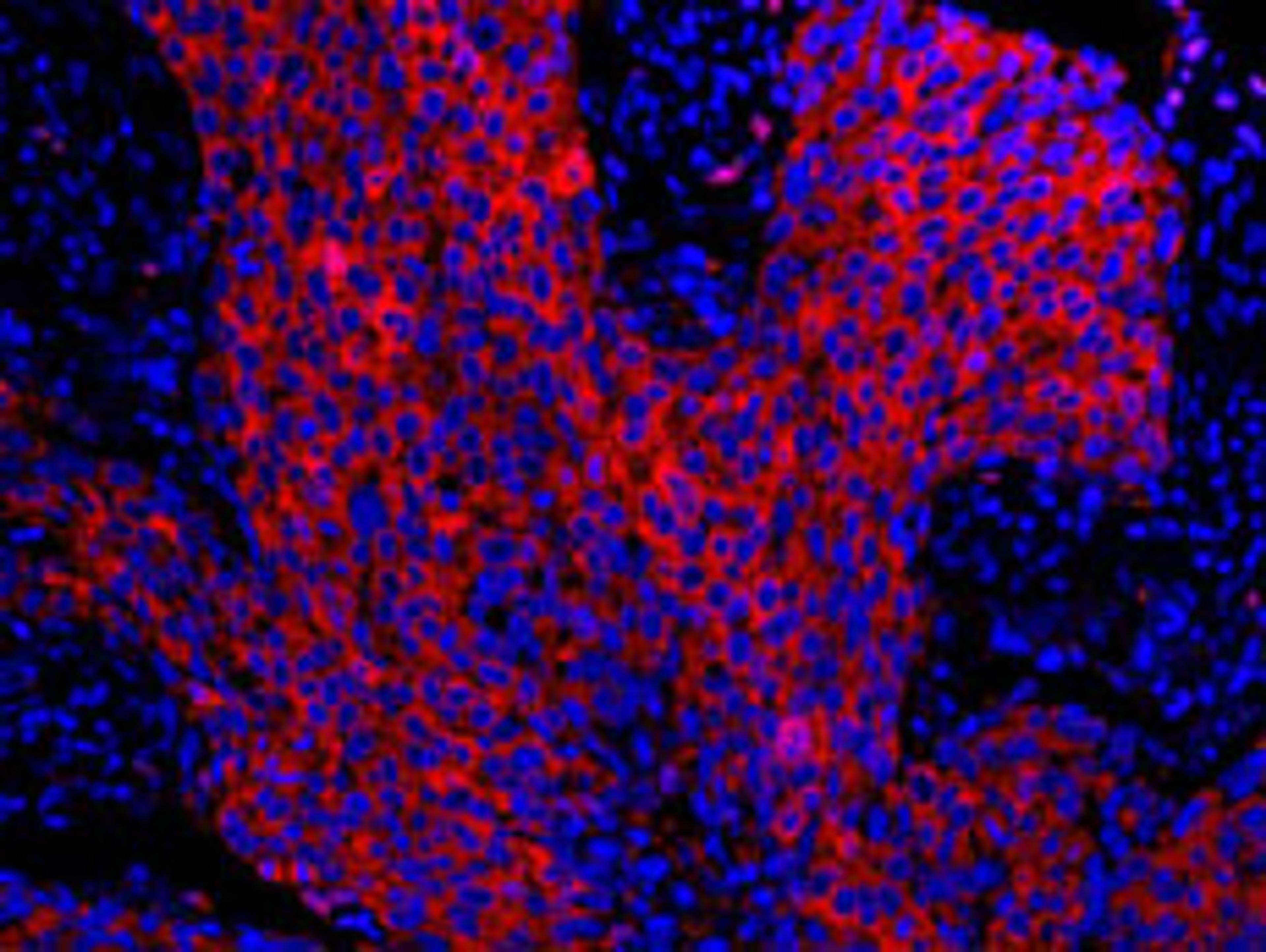 Detection of human 14-3-3 Sigma by immunohistochemistry.