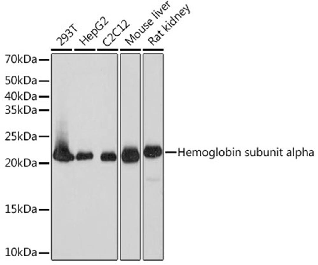 Western blot - DHFR  Rabbit mAb (A9299)