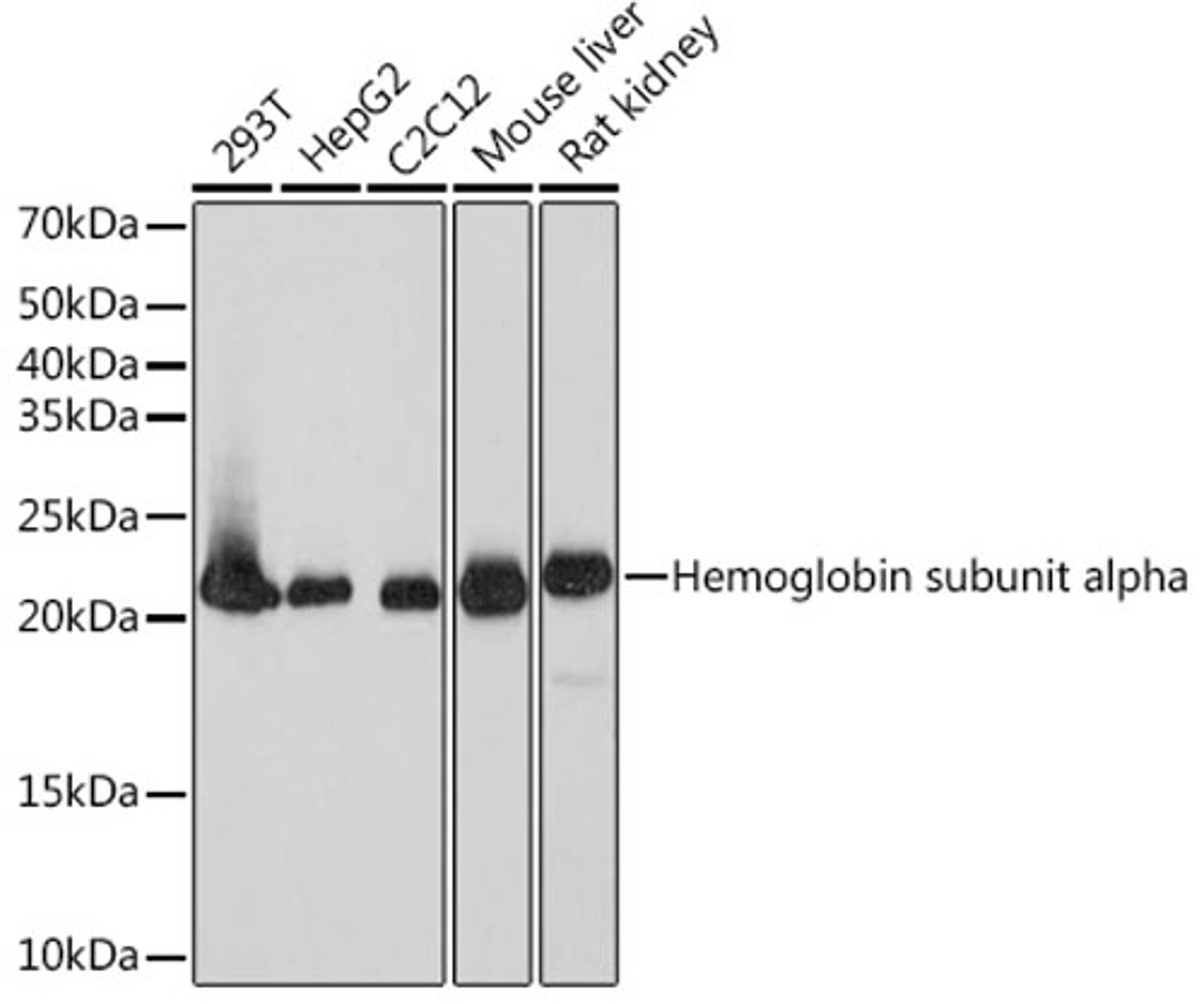 Western blot - DHFR  Rabbit mAb (A9299)