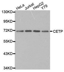 Western blot analysis of extracts of various cell lines using CETP antibody