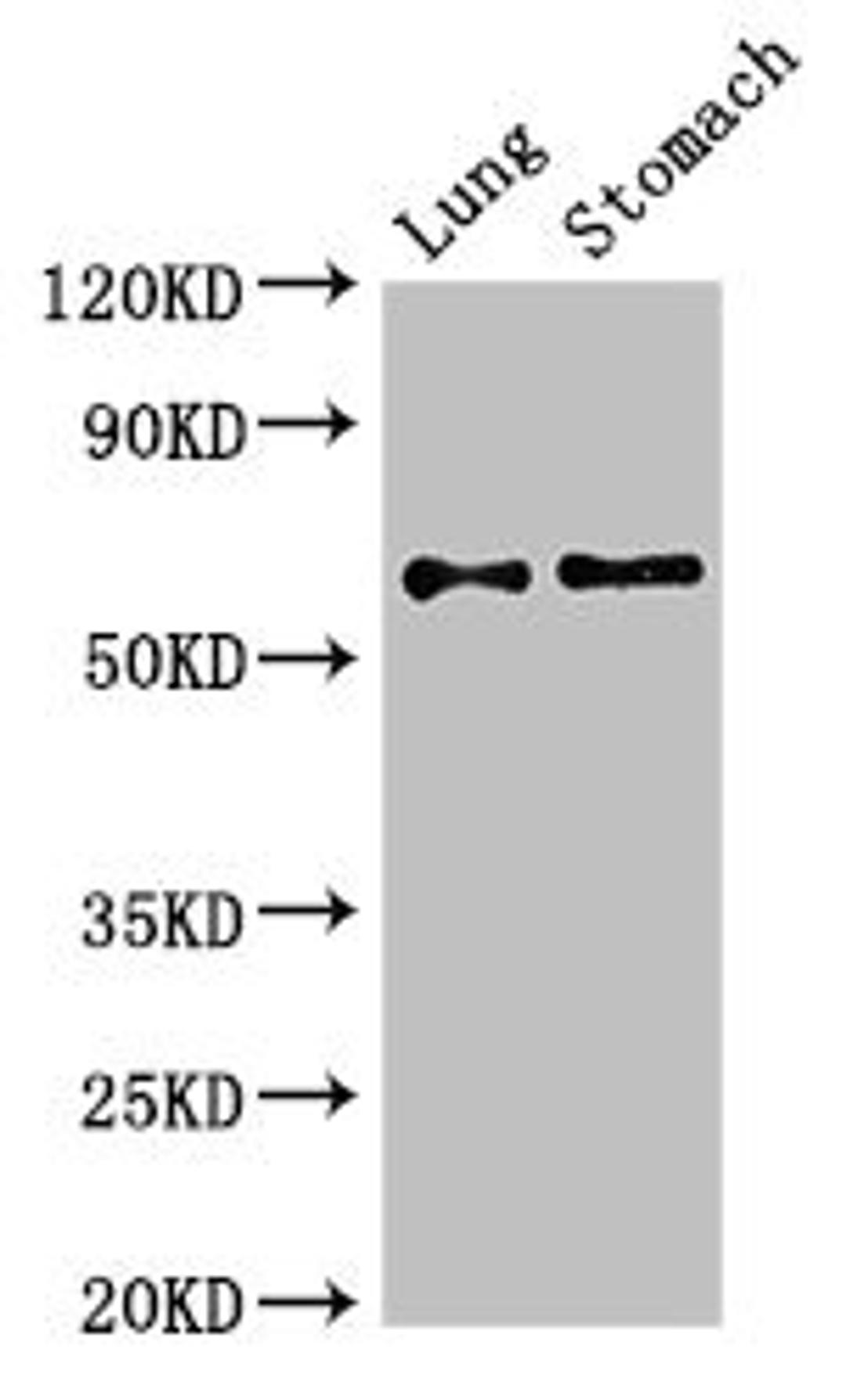 Western Blot. Positive WB detected in: Mouse lung tissue, Mouse stomach tissue. All lanes: GAD2 antibody at 2.7ug/ml. Secondary. Goat polyclonal to rabbit IgG at 1/50000 dilution. Predicted band size: 66 kDa. Observed band size: 66 kDa. 