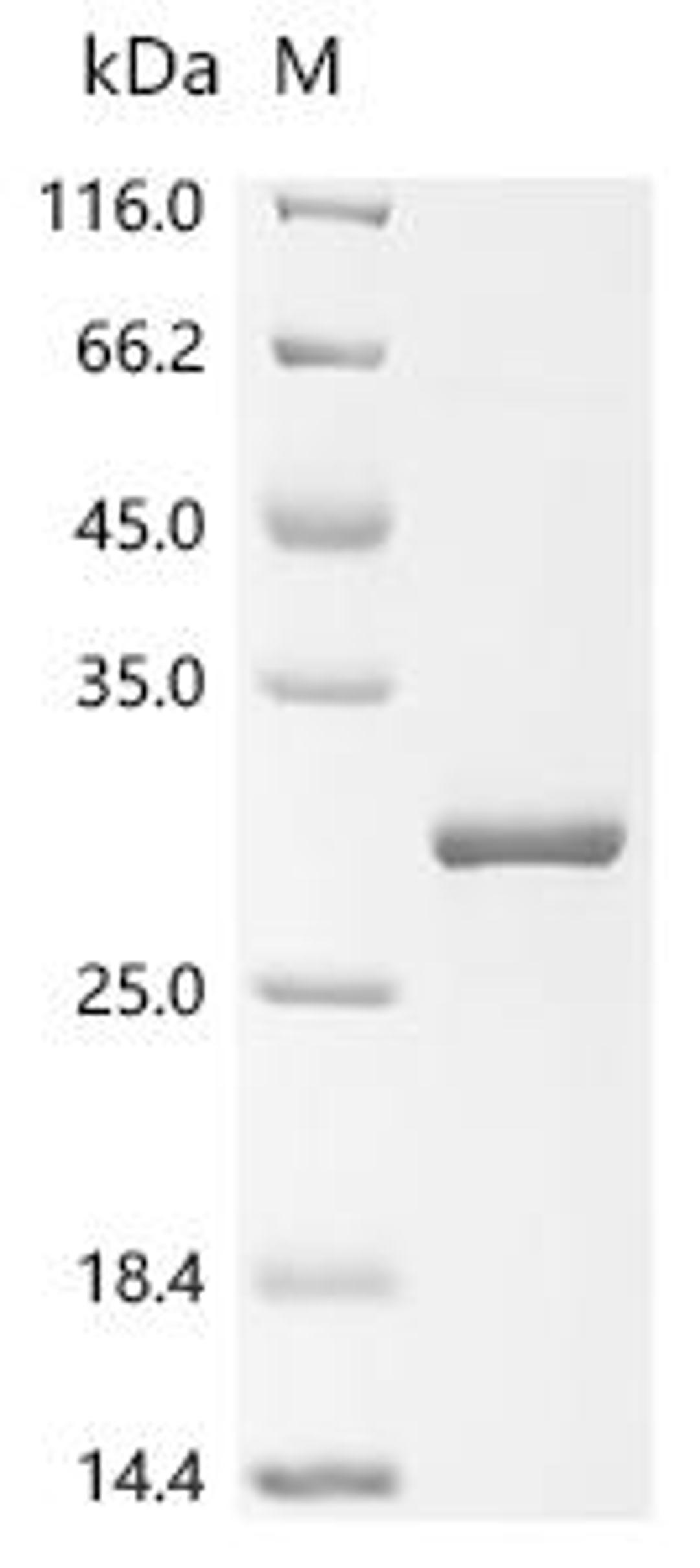 (Tris-Glycine gel) Discontinuous SDS-PAGE (reduced) with 5% enrichment gel and 15% separation gel.