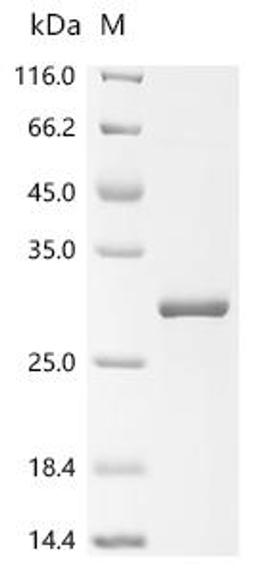 (Tris-Glycine gel) Discontinuous SDS-PAGE (reduced) with 5% enrichment gel and 15% separation gel.