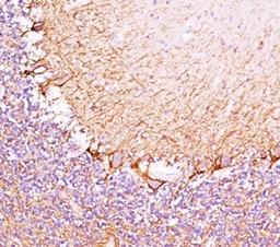 IHC testing of cerebellum stained with Neurofilament Heavy antibody (RT97).