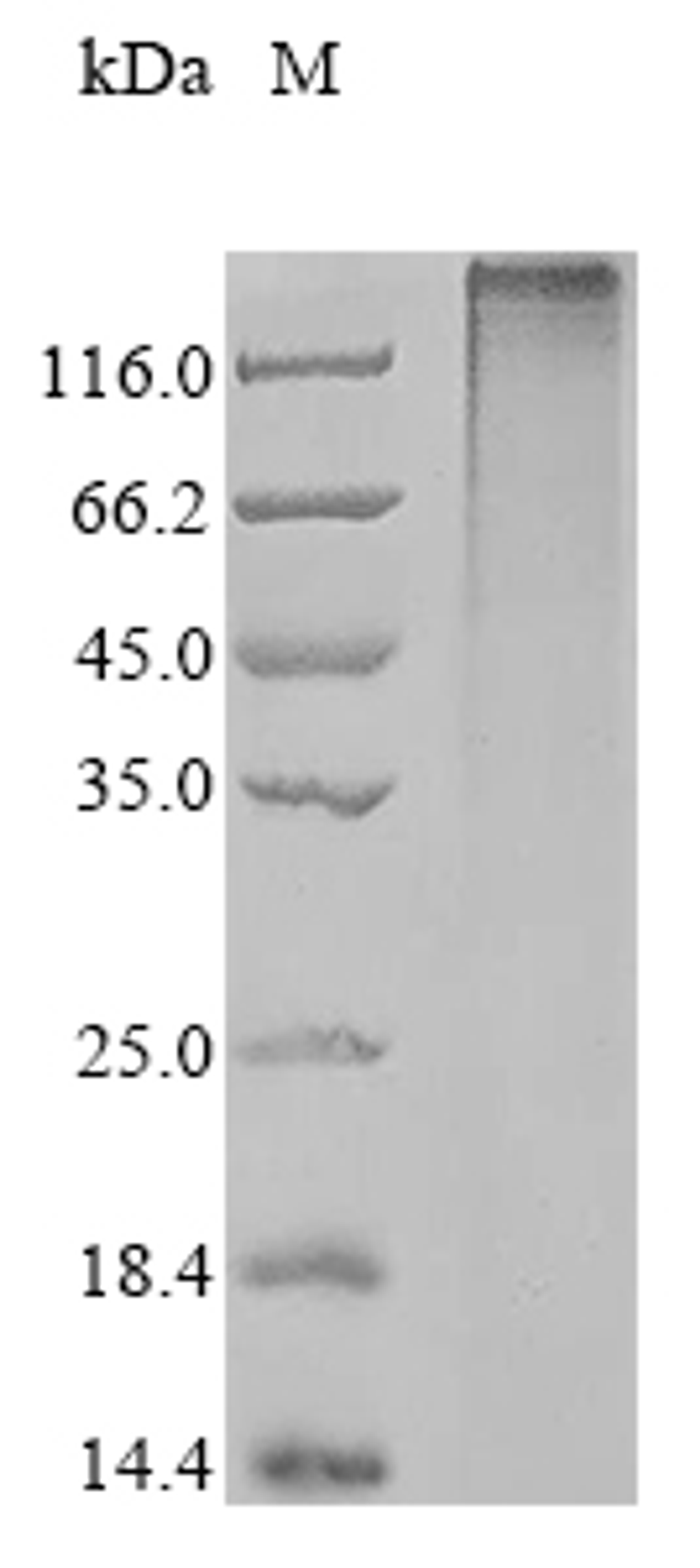 (Tris-Glycine gel) Discontinuous SDS-PAGE (reduced) with 5% enrichment gel and 15% separation gel.