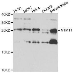 Western blot analysis of extracts of various cell lines using NTMT1 antibody