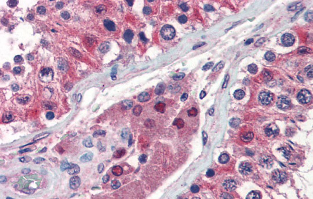 Antibody used in IHC on Human Testis at 5 ug/ml.