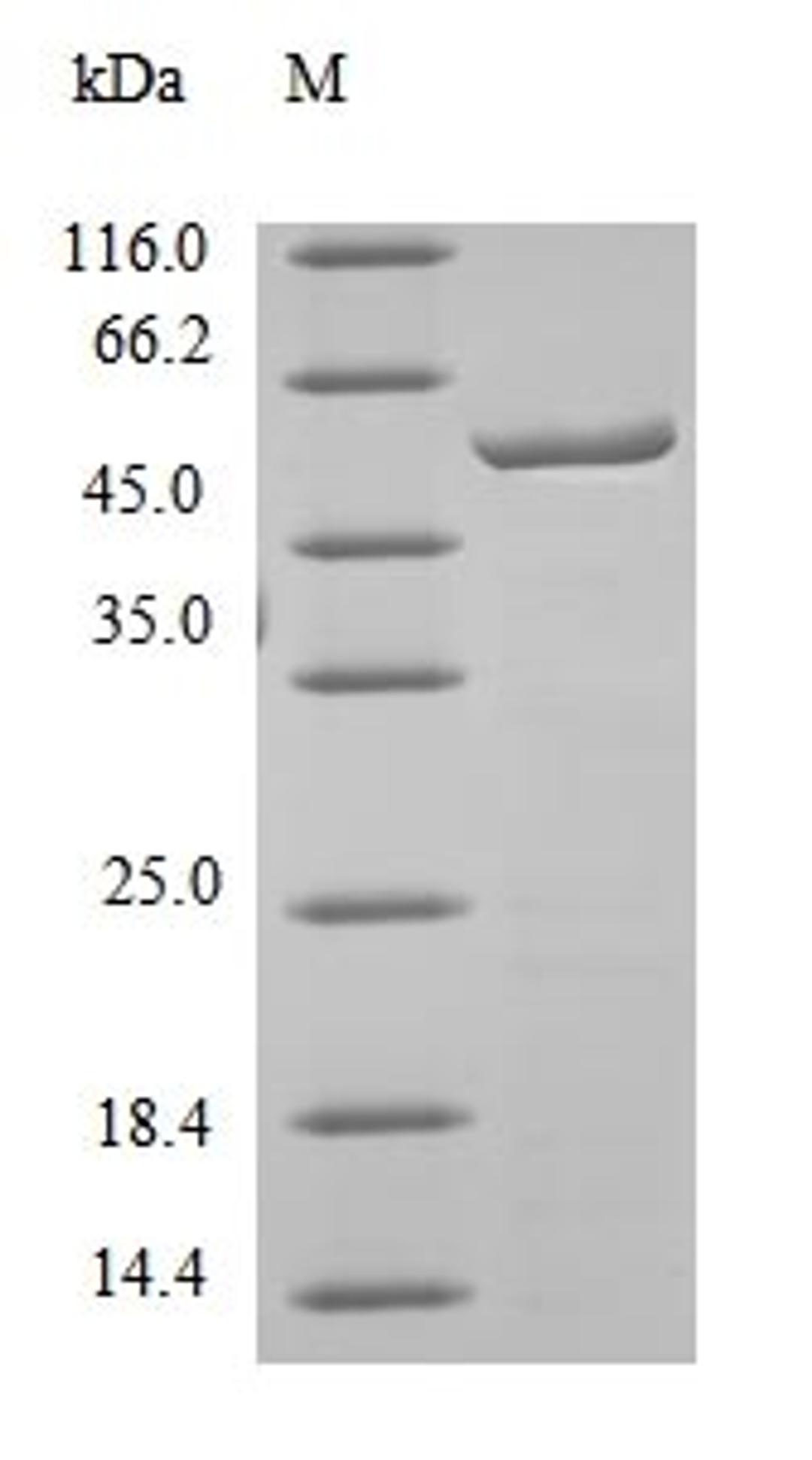 (Tris-Glycine gel) Discontinuous SDS-PAGE (reduced) with 5% enrichment gel and 15% separation gel.