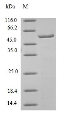 (Tris-Glycine gel) Discontinuous SDS-PAGE (reduced) with 5% enrichment gel and 15% separation gel.