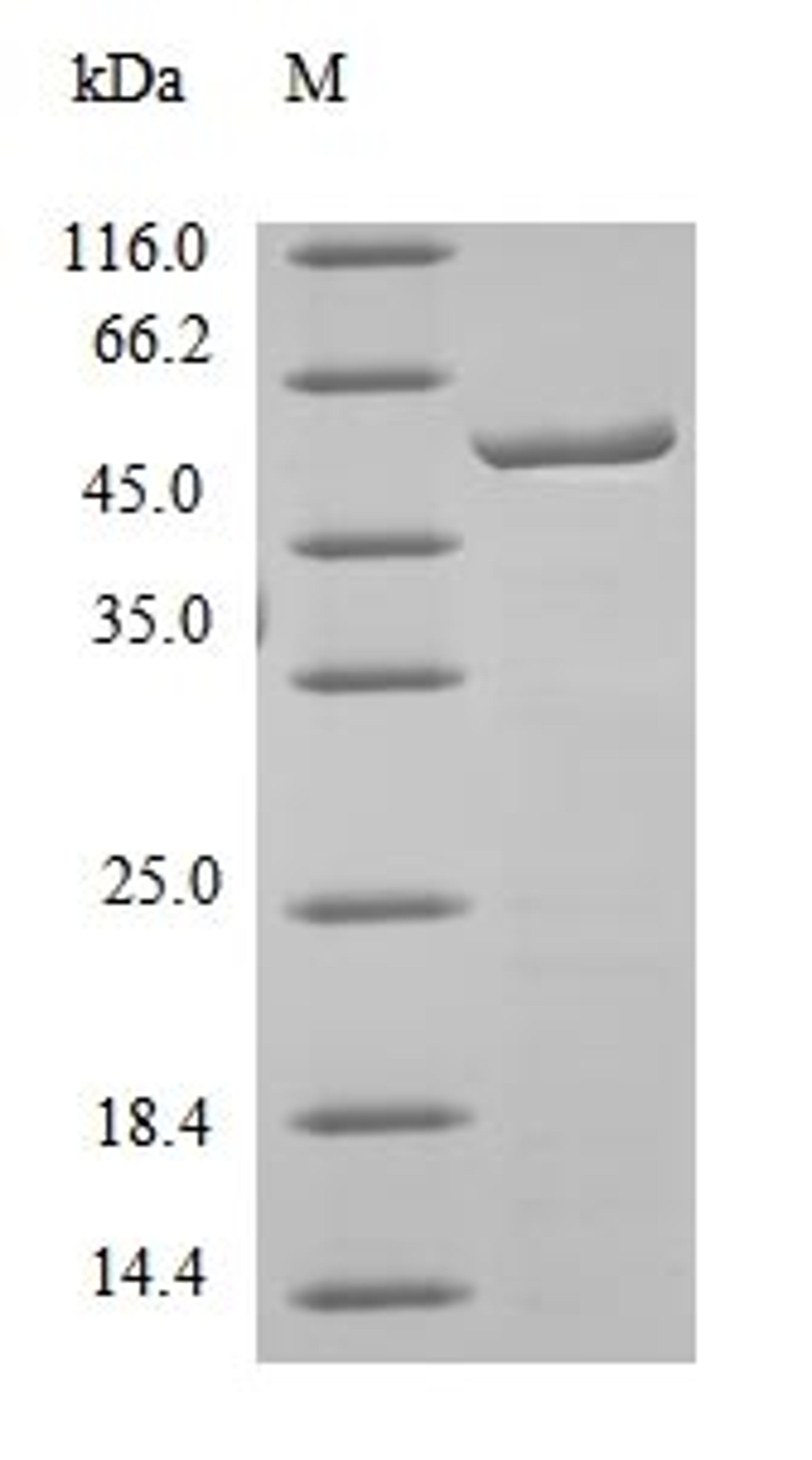 (Tris-Glycine gel) Discontinuous SDS-PAGE (reduced) with 5% enrichment gel and 15% separation gel.