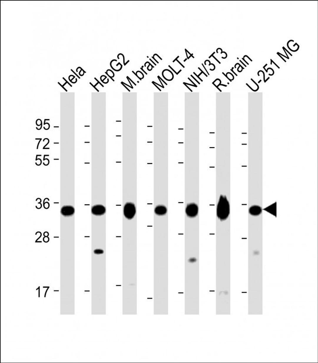 Western Blot at 1:2000 dilution Lane 1: Hela whole cell lysate Lane 2: HepG2 whole cell lysate Lane 3: mouse brain lysate Lane 4: MOLT-4 whole cell lysate Lane 5: NIH/3T3 whole cell lysate Lane 6: rat brain lysate Lane 7: U-251 MG whole cell lysate Lysate