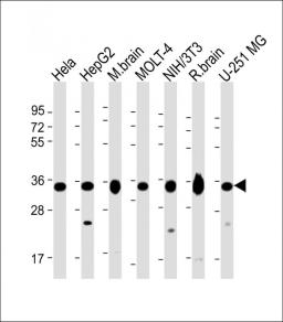 Western Blot at 1:2000 dilution Lane 1: Hela whole cell lysate Lane 2: HepG2 whole cell lysate Lane 3: mouse brain lysate Lane 4: MOLT-4 whole cell lysate Lane 5: NIH/3T3 whole cell lysate Lane 6: rat brain lysate Lane 7: U-251 MG whole cell lysate Lysate