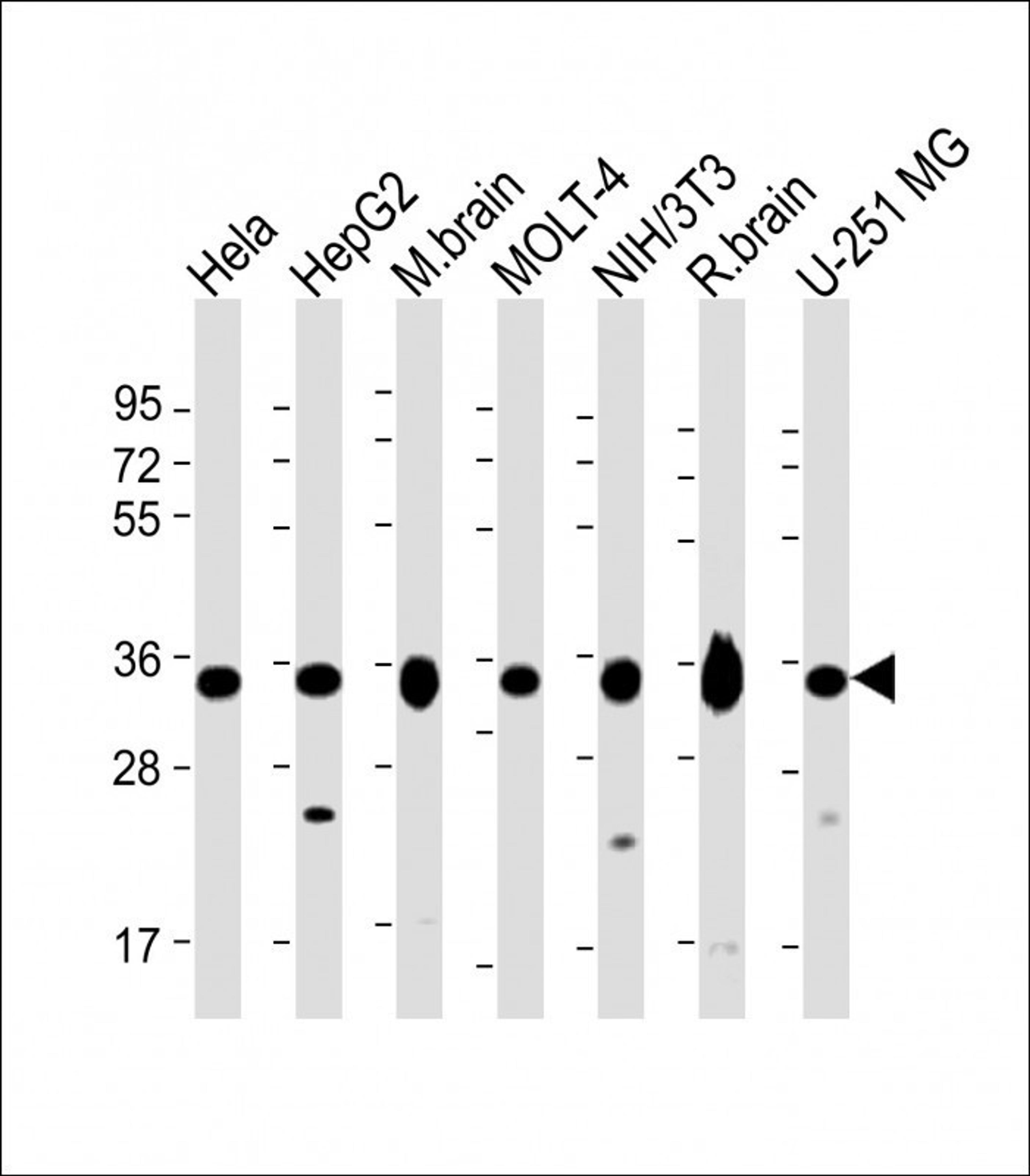 Western Blot at 1:2000 dilution Lane 1: Hela whole cell lysate Lane 2: HepG2 whole cell lysate Lane 3: mouse brain lysate Lane 4: MOLT-4 whole cell lysate Lane 5: NIH/3T3 whole cell lysate Lane 6: rat brain lysate Lane 7: U-251 MG whole cell lysate Lysate