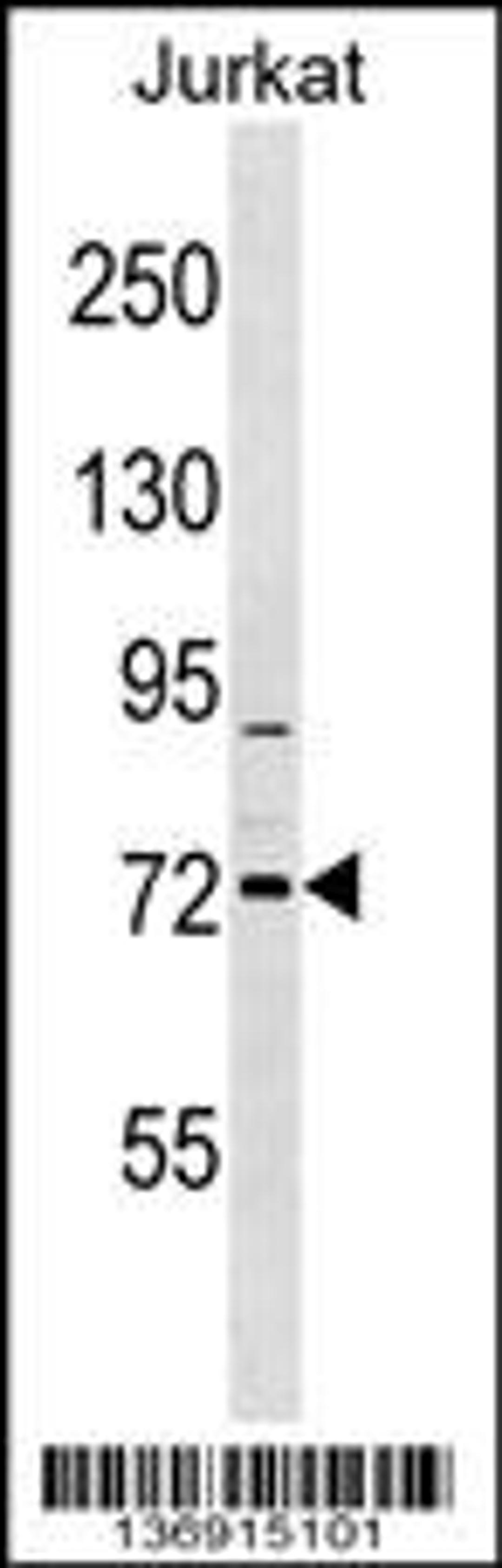 Western blot analysis in Jurkat cell line lysates (35ug/lane).