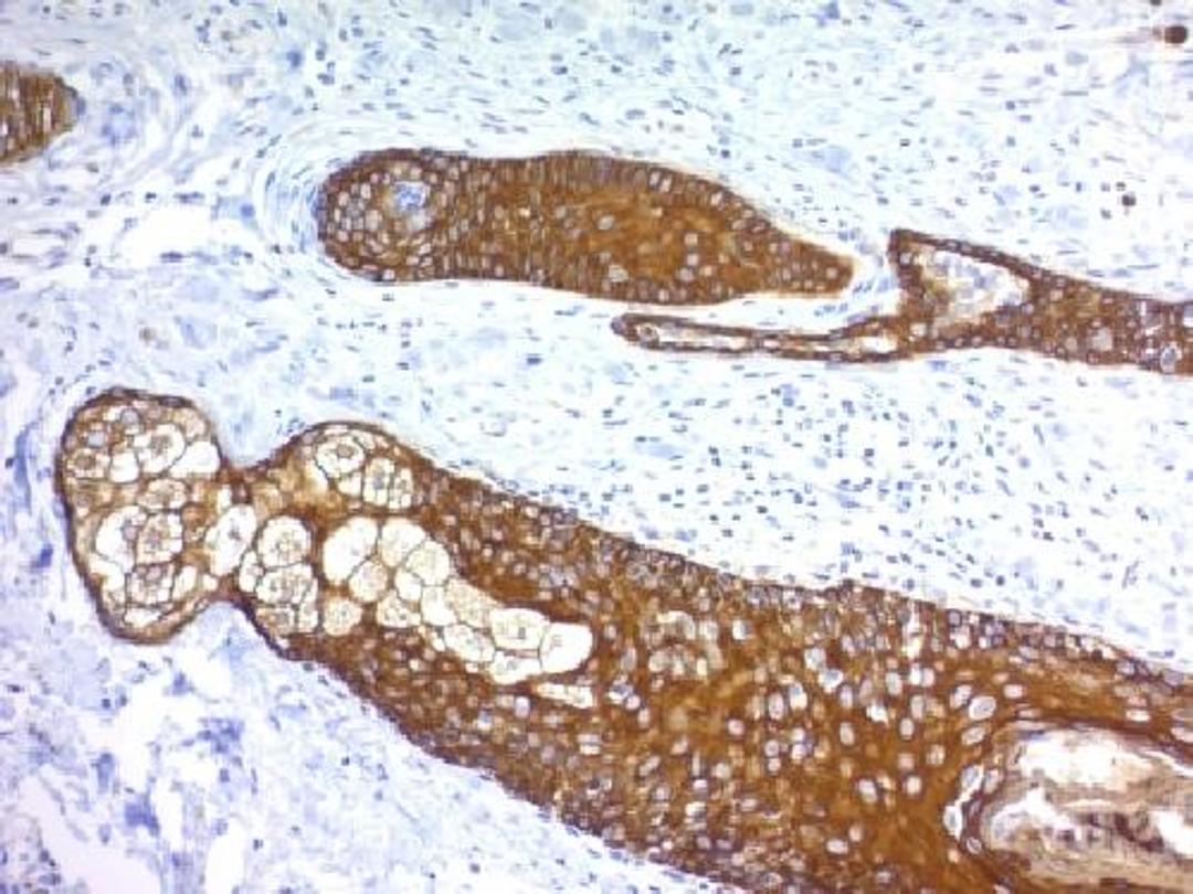 Immunohistochemical staining of human Skin tissue using KRT76 antibody