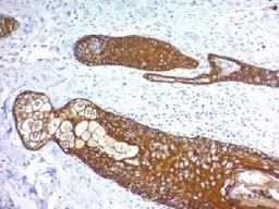 Immunohistochemical staining of human Skin tissue using KRT76 antibody