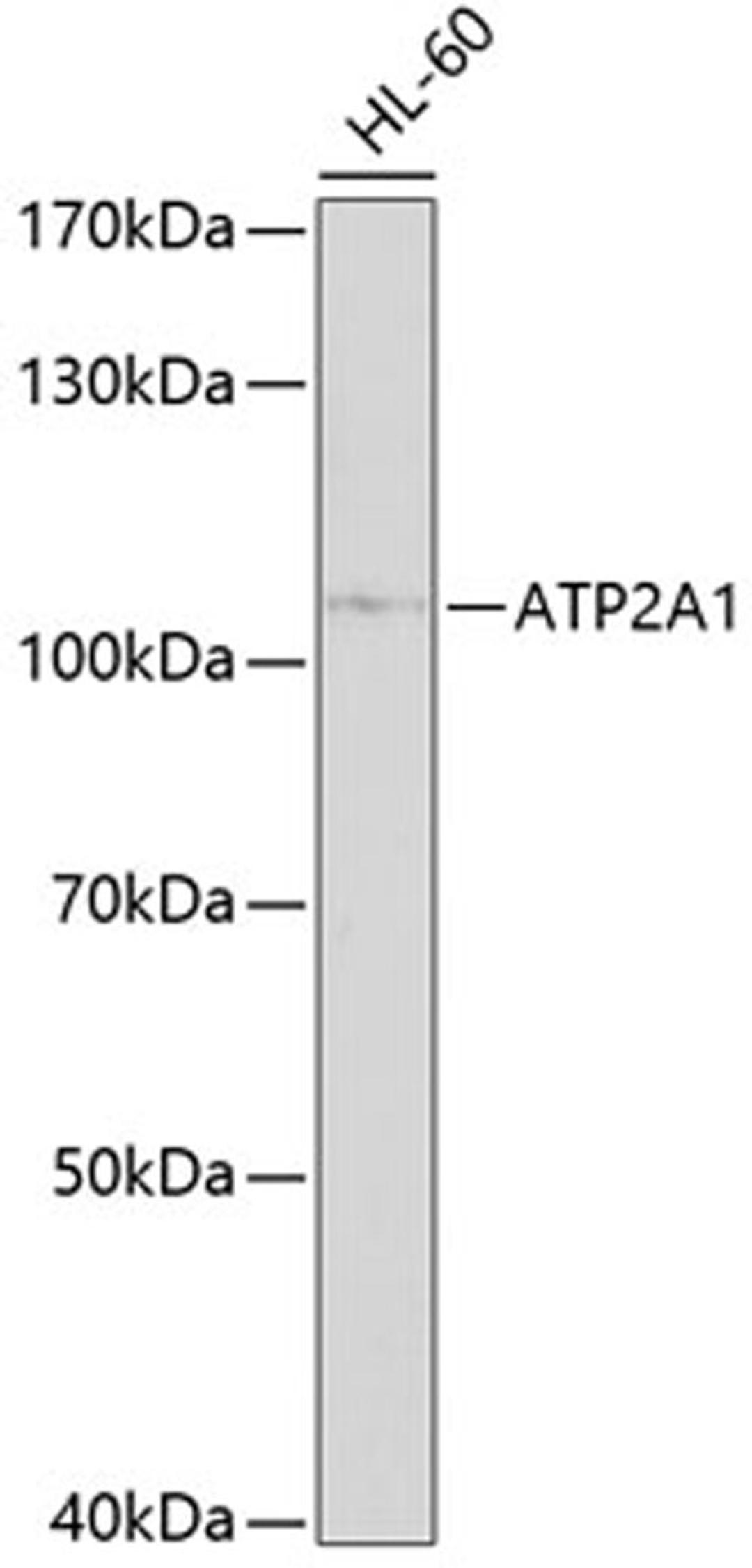 Western blot - ATP2A1 antibody (A10104)