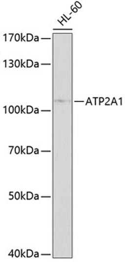 Western blot - ATP2A1 antibody (A10104)