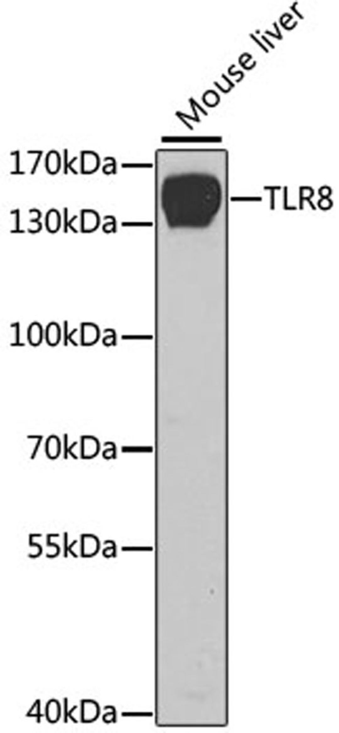 Western blot - TLR8 antibody (A1489)