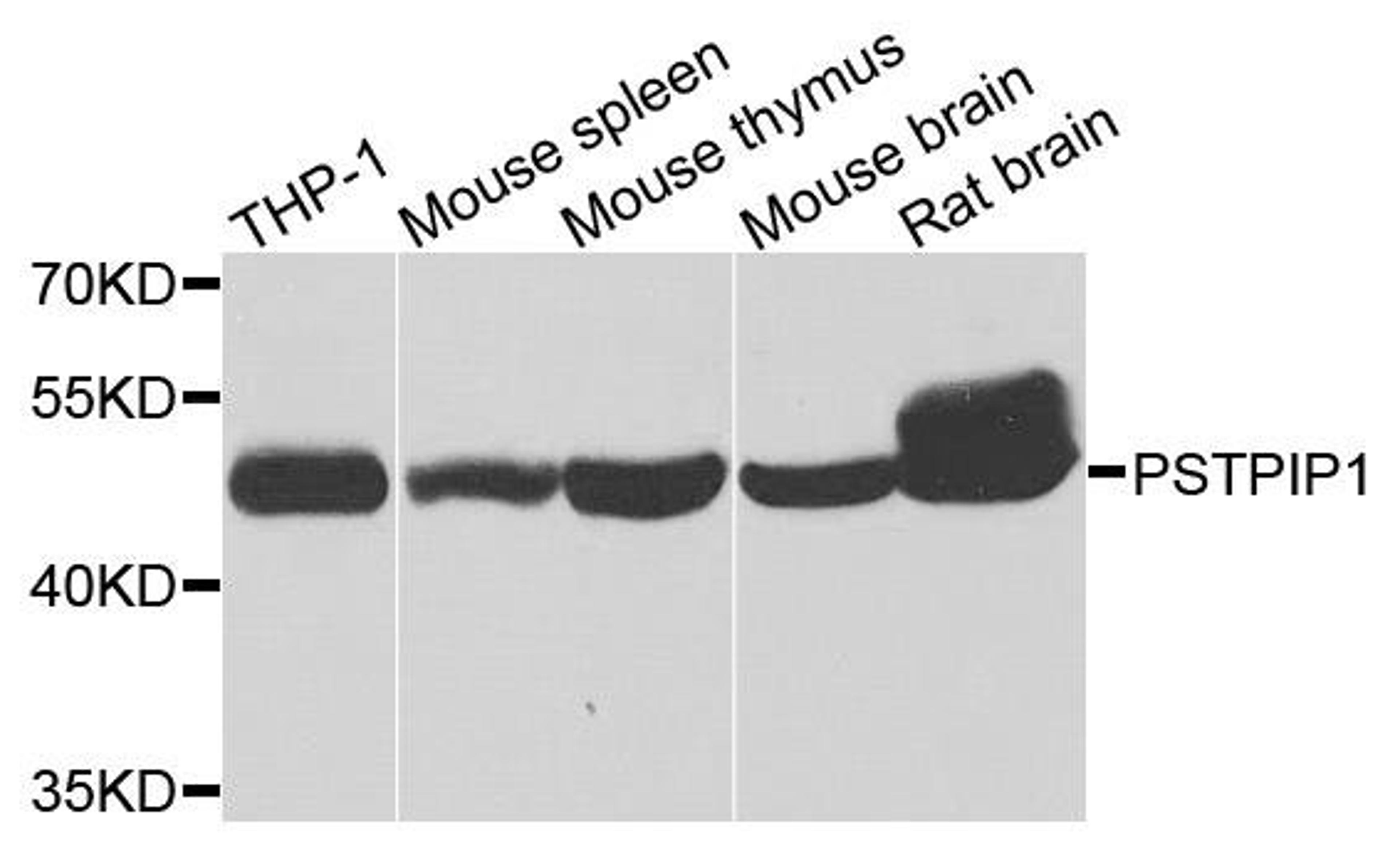 Western blot analysis of extracts of various cells using PSTPIP1 antibody