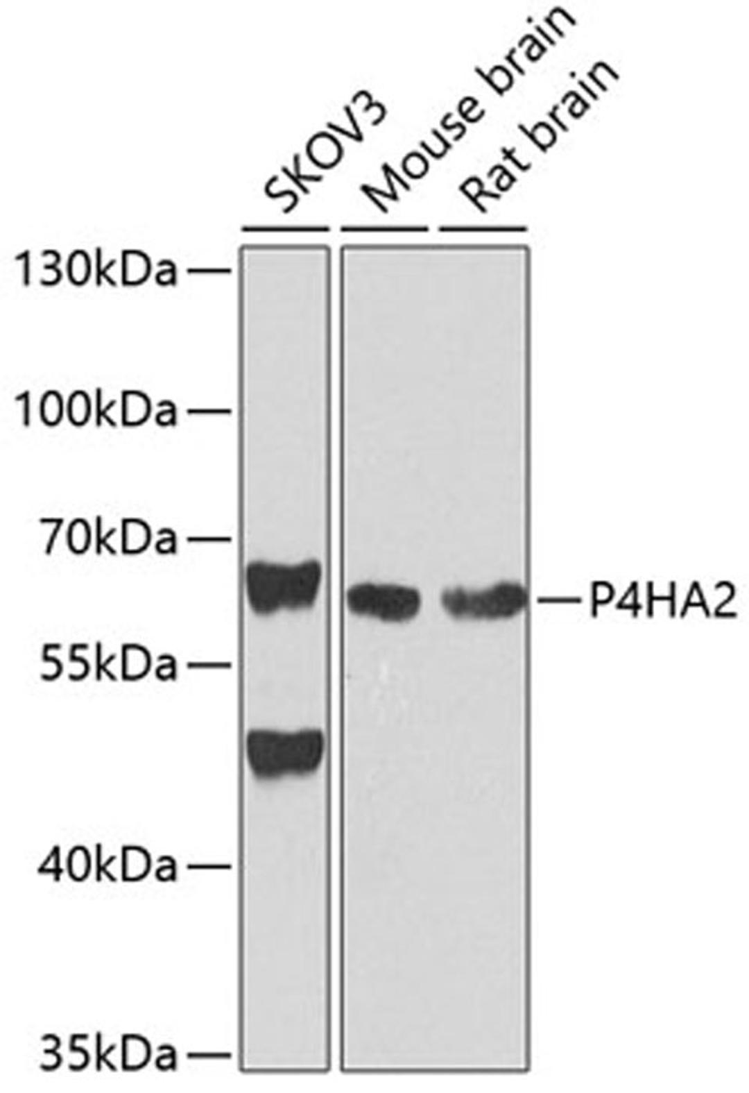 Western blot - P4HA2 antibody (A4262)